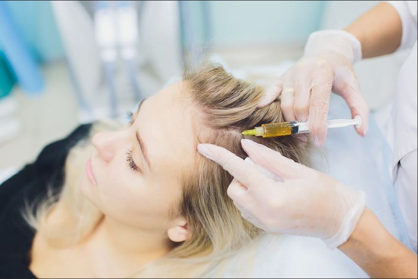 PRP treatment for hair loss